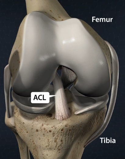 Anterior Cruciate Ligament (ACL)