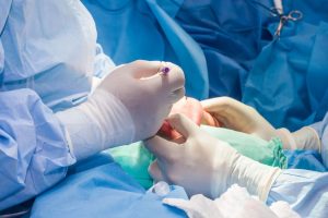 Doctors Operating on a Hand